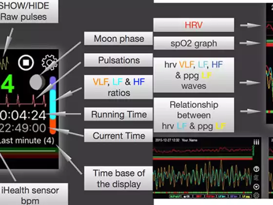 itHRVE- HRV Heart Biofeedback- Coherence / Stress / Sacral Cranial Measurement