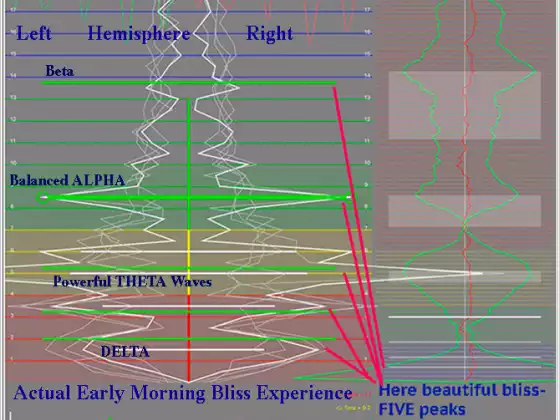 Patrick Botte: ItHRVe.com, FlameinMind.com  Heart/Breath EEG Biofeedback Apps